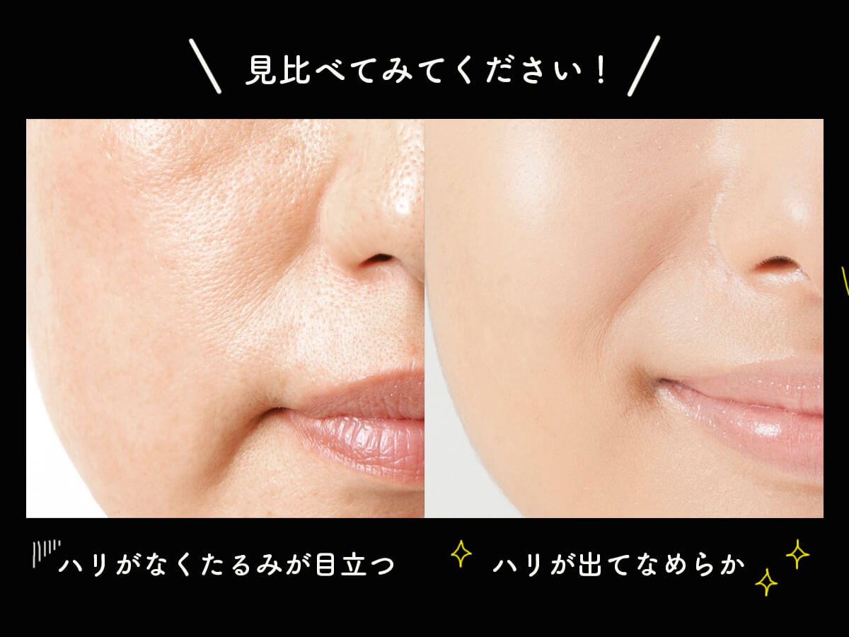 ビフォーアフター